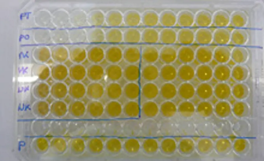 Test d’inhibition de l’acétylcholine estérase