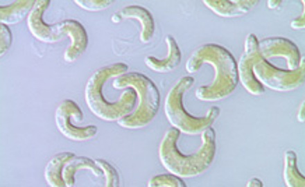 Test algues combiné sur algues vertes unicellulaires