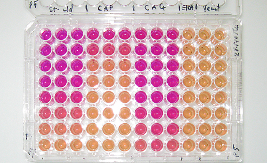 Utilisation des bioessais pour la détection des œstrogènes dans les eaux de surface - Etude comparative de cinq tests in vitro